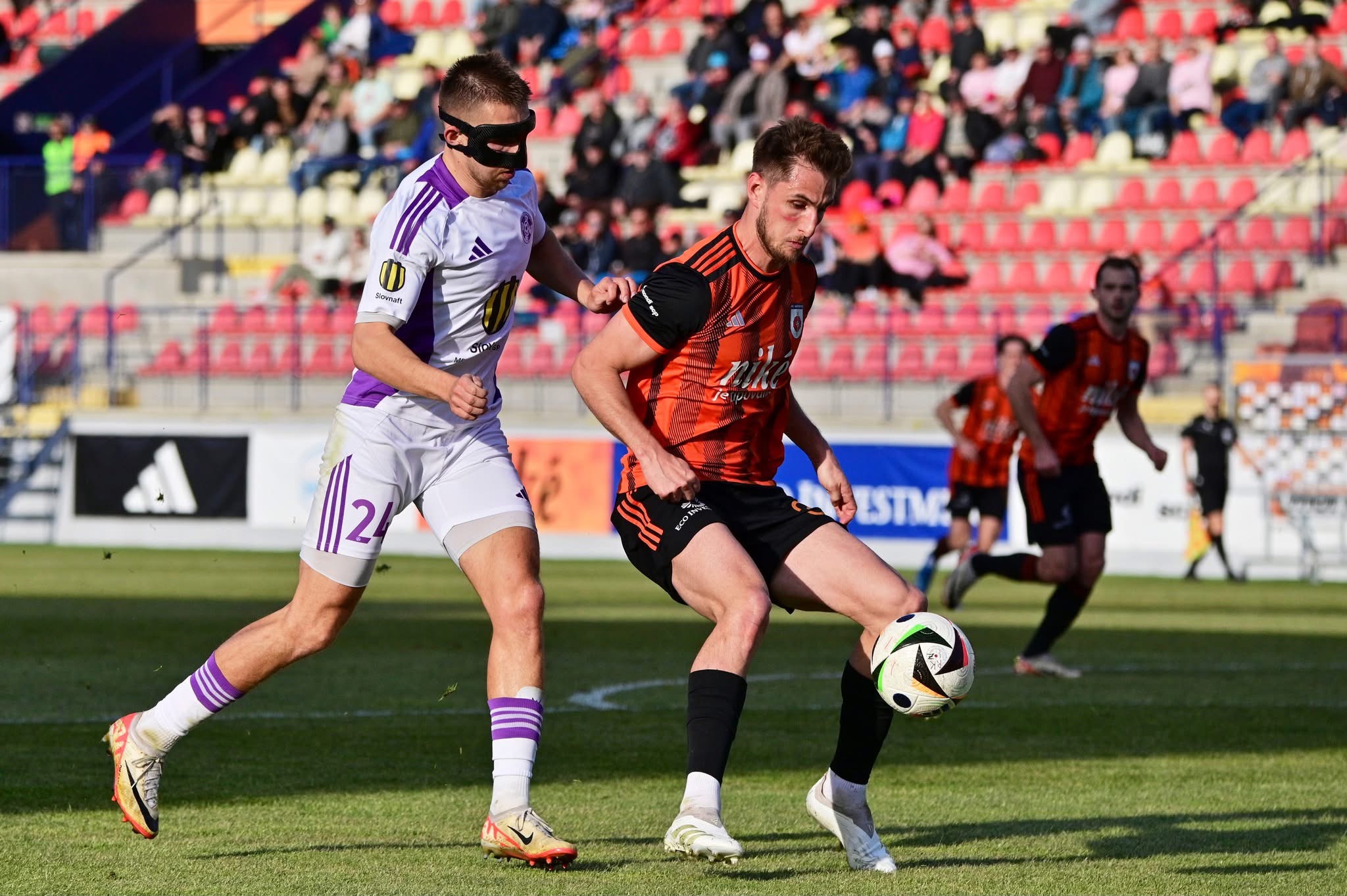 A broken nose, blood on the field… and back in training six days later.